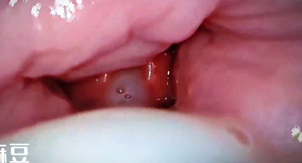 Cô giáo mượn tinh trùng của học sinh vì chồng cô bị liệt dương và không thể rụng trứn